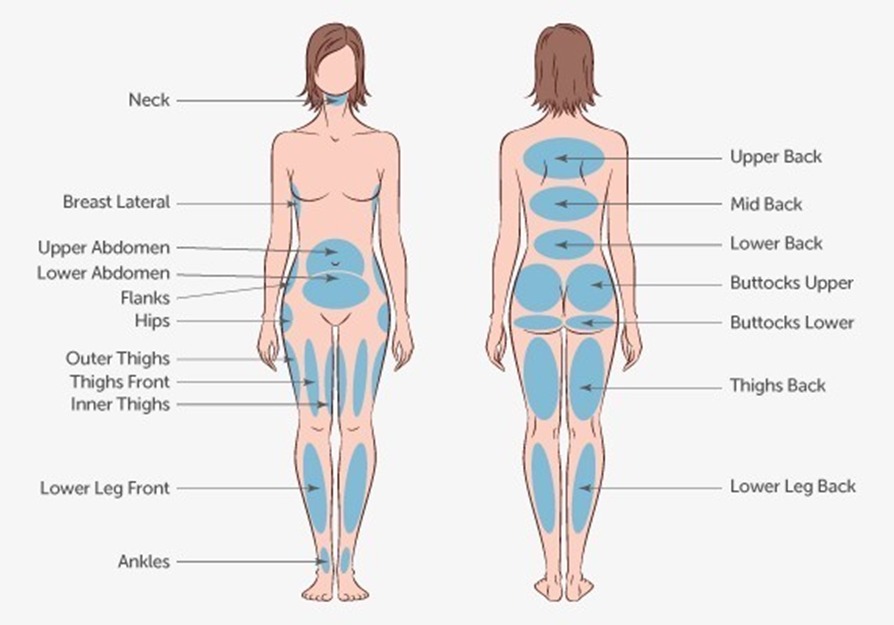 LIPOSUCTION